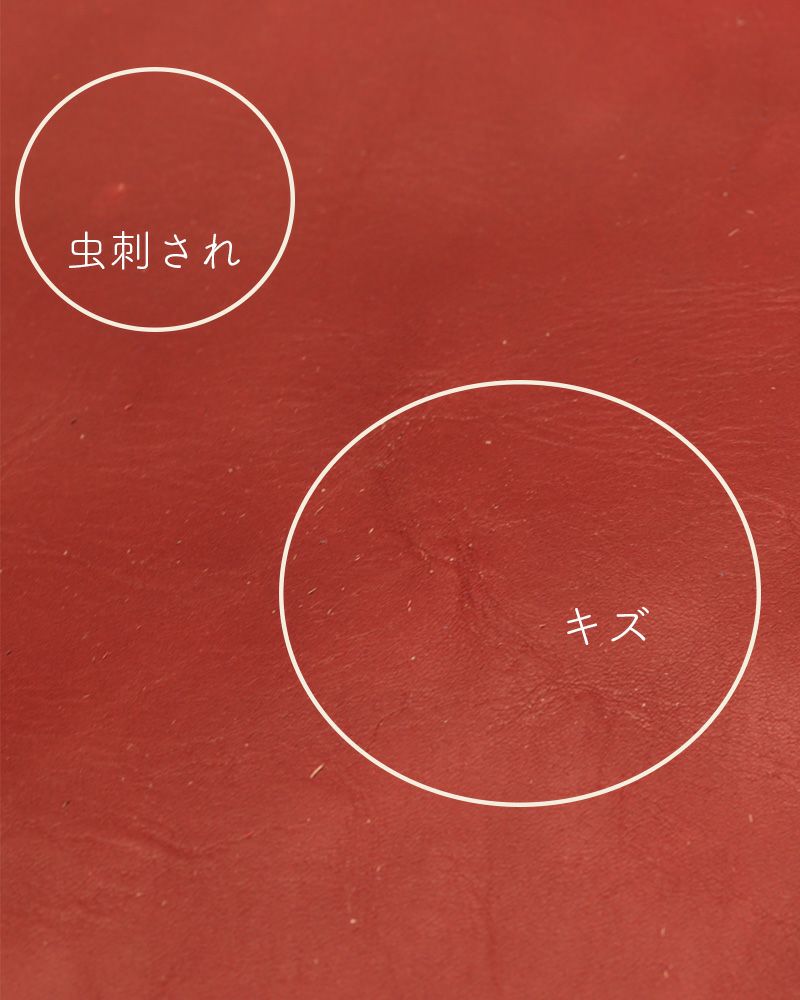 ナバルの革の虫刺され・傷の例